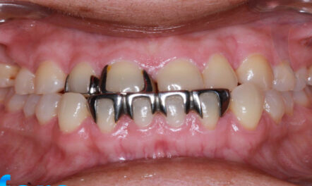 tj endodontics